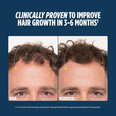 Men's Hair Growth