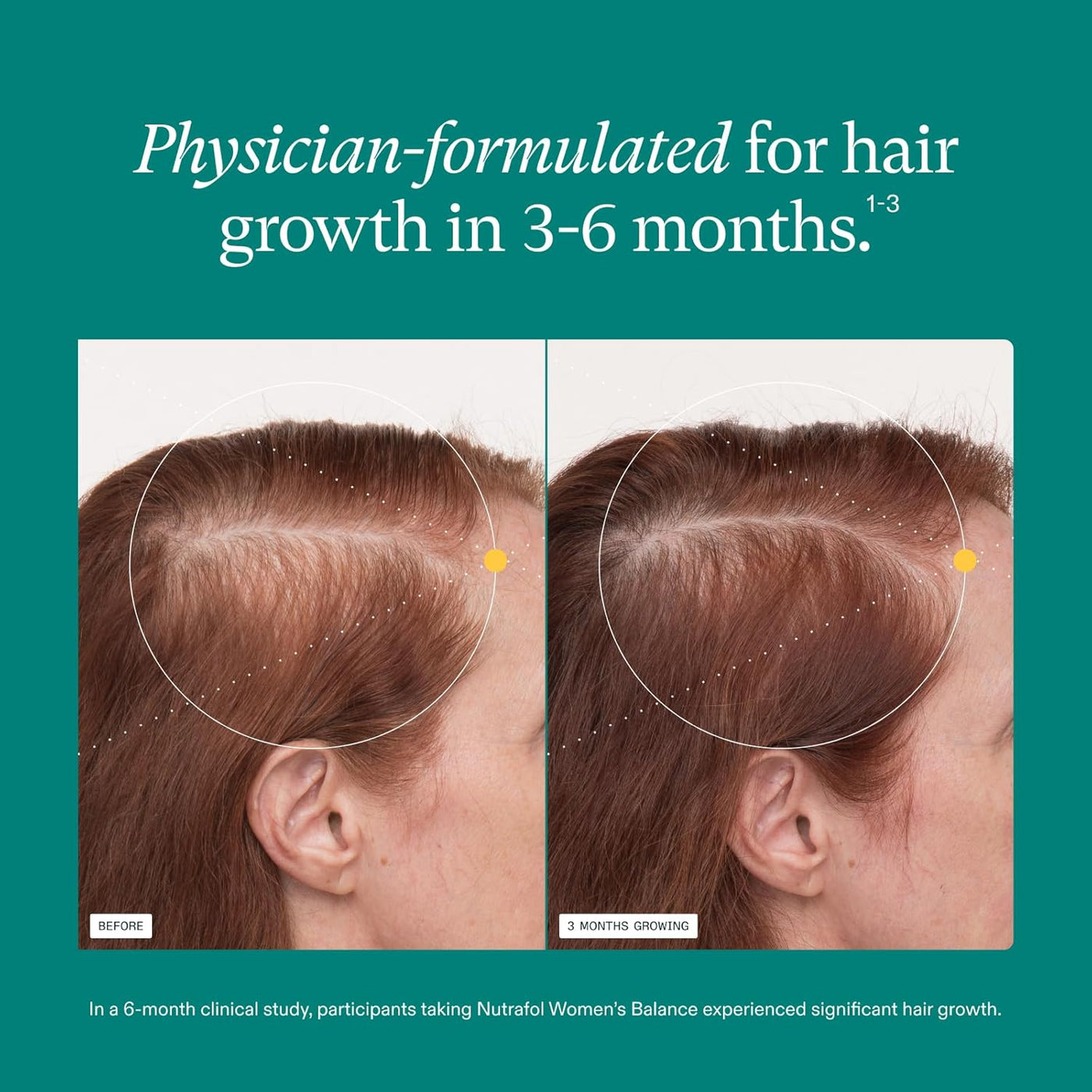 Women's Balance Hair Growth