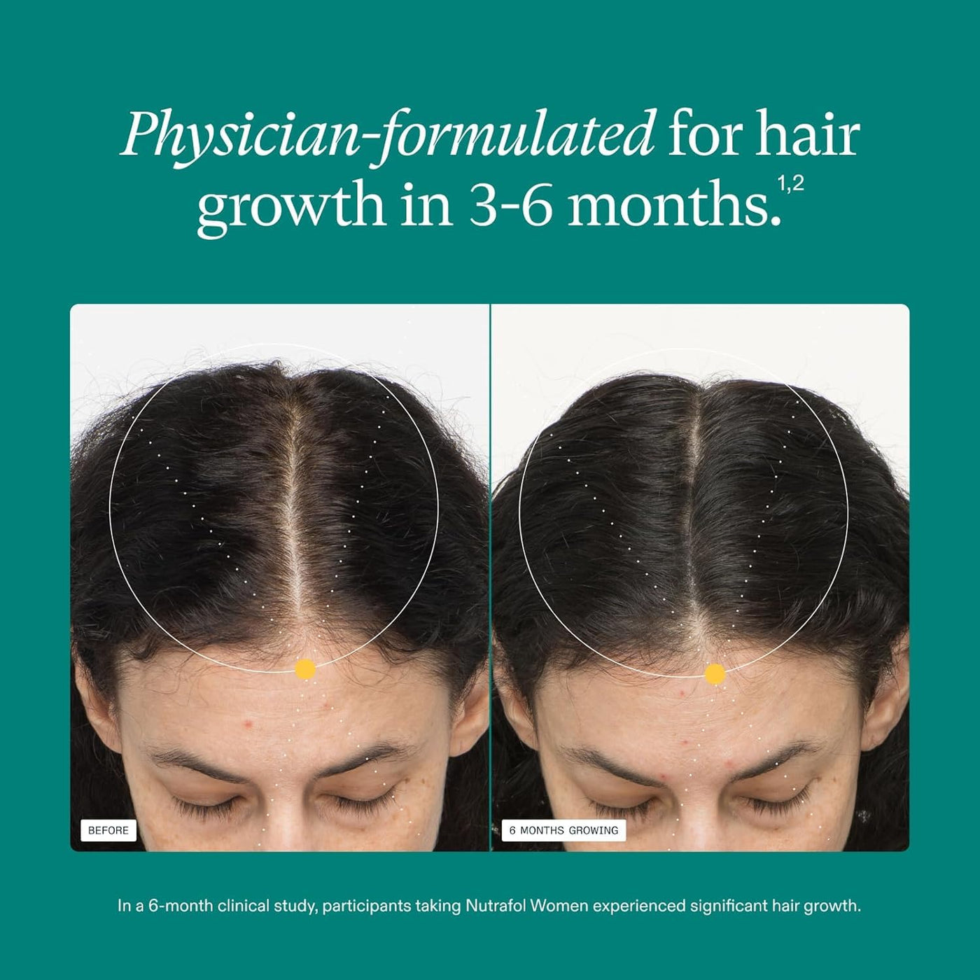 Women's Hair Growth