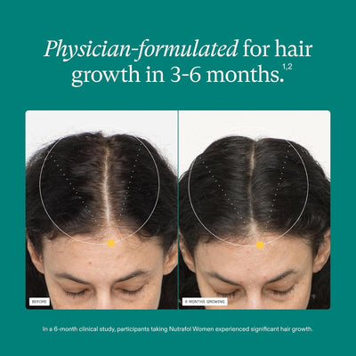 Women's Hair Growth